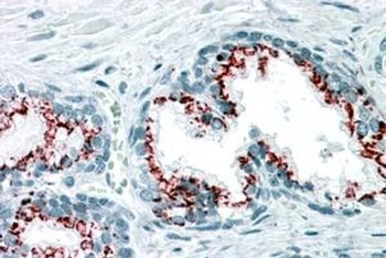 GOLM1 Antibody