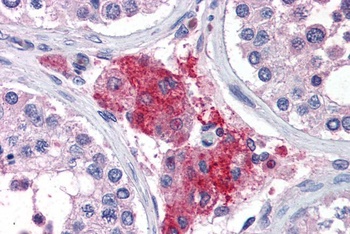 GALR1 Antibody