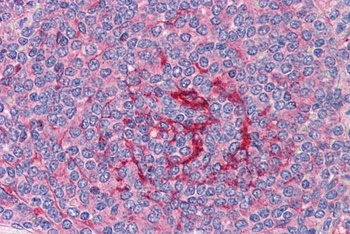 GABPB2 Antibody