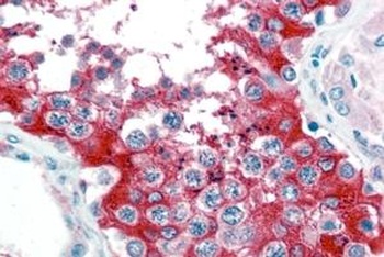 G6PD Antibody