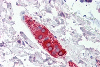 FEZ1 Antibody