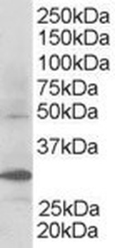 FBXW2 Antibody