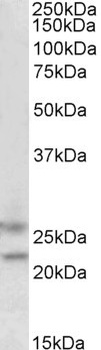 FBXO44 Antibody