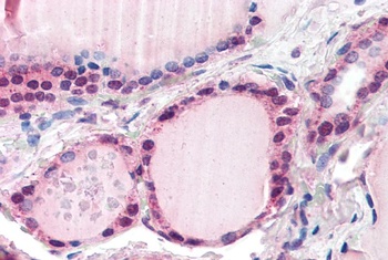 FBXL3 Antibody