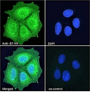 Fascin 2 Antibody
