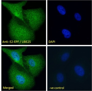 E2-EPF Antibody