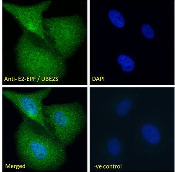 UBE2S Antibody