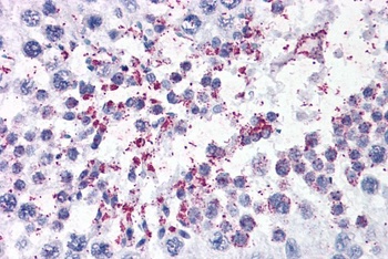 DUSP14 Antibody