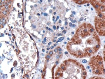 DARC Antibody