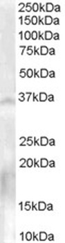 DOPA decarboxylase Antibody