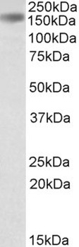 DCDC2 alpha Antibody