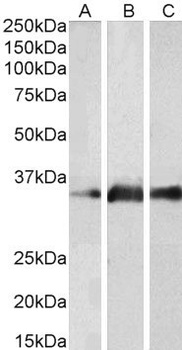 CYLD Antibody