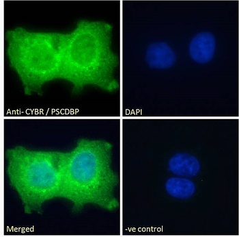 CYBR Antibody