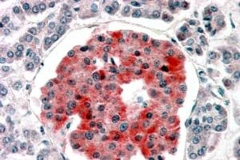 CRP2 Antibody
