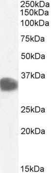 CBR1 Antibody