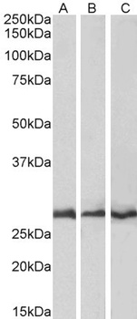 CAPZB Antibody