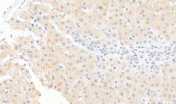 Bradykinin Receptor B1 Antibody