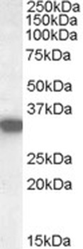 Arylsulfatase B Antibody