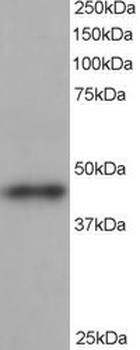 ACTR1B Antibody