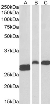 ANP32B Antibody