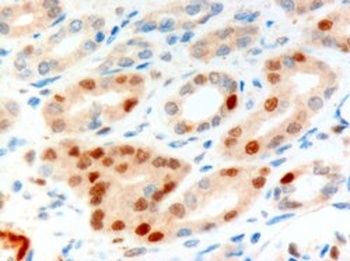 ANLN Antibody