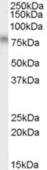 ACYP1 Antibody