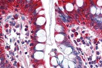 ACSL5 Antibody