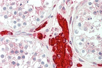 PGRMC1 Antibody