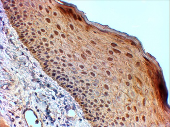 14-3-3 sigma Antibody