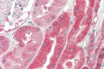 VHL Antibody