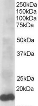 UBE2L3 Antibody