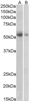 SLC18A2 Antibody