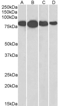 Radixin Antibody