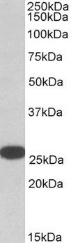 RANBP1 Antibody