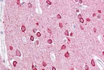 PACSIN1 Antibody