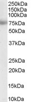 MTA1 Antibody