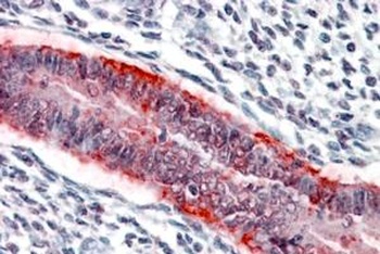 MMP-7 Antibody