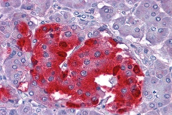 Chromogranin A Antibody