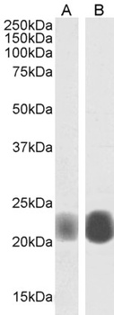 Caveolin-1 Antibody