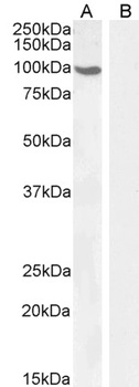 AR Antibody