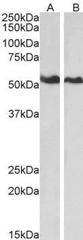 ANXA11 Antibody