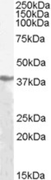 ADH1 Antibody