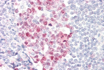 CXCR7 / RDC1 Antibody