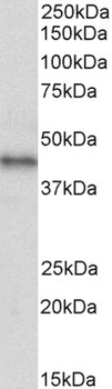 CSNK2B Antibody
