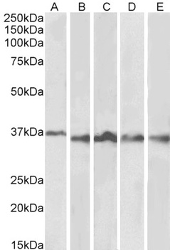 SRRT / ARS2 Antibody