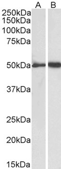 PLA2G2A Antibody