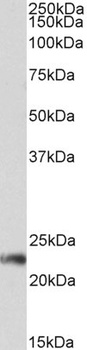 FCER1A Antibody