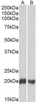 GNL3 Antibody