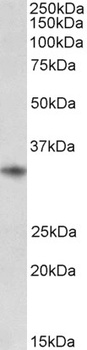 MSI2/musashi-2 Antibody