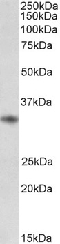 MSI2 / musashi-2 Antibody